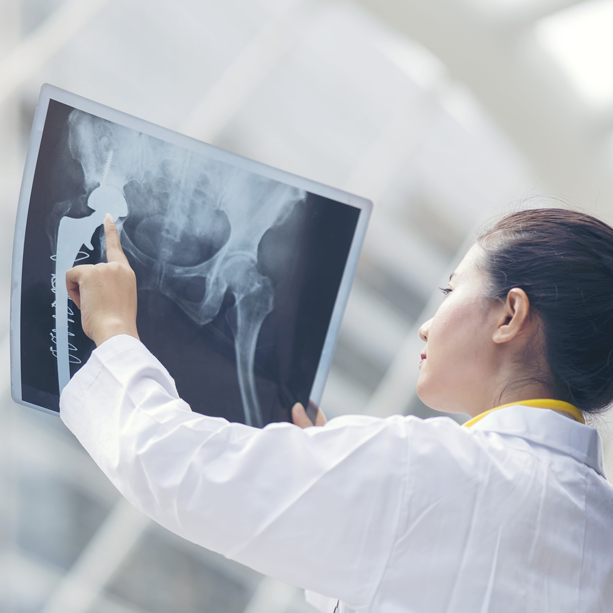 Personal Injury Lawyers at Hannon Legal Group