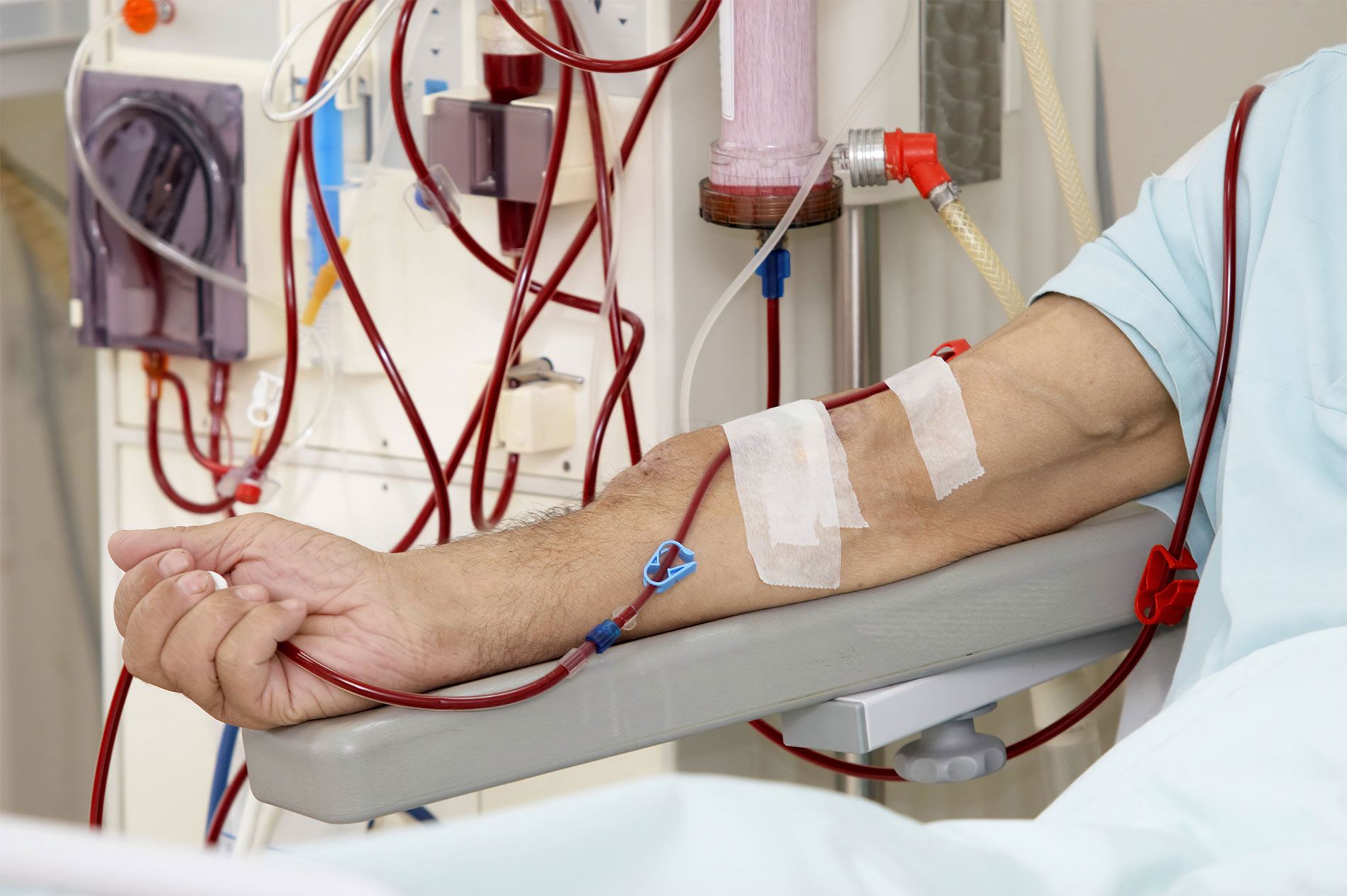 Kidney Dialysis Malpractice Hannon Legal Group